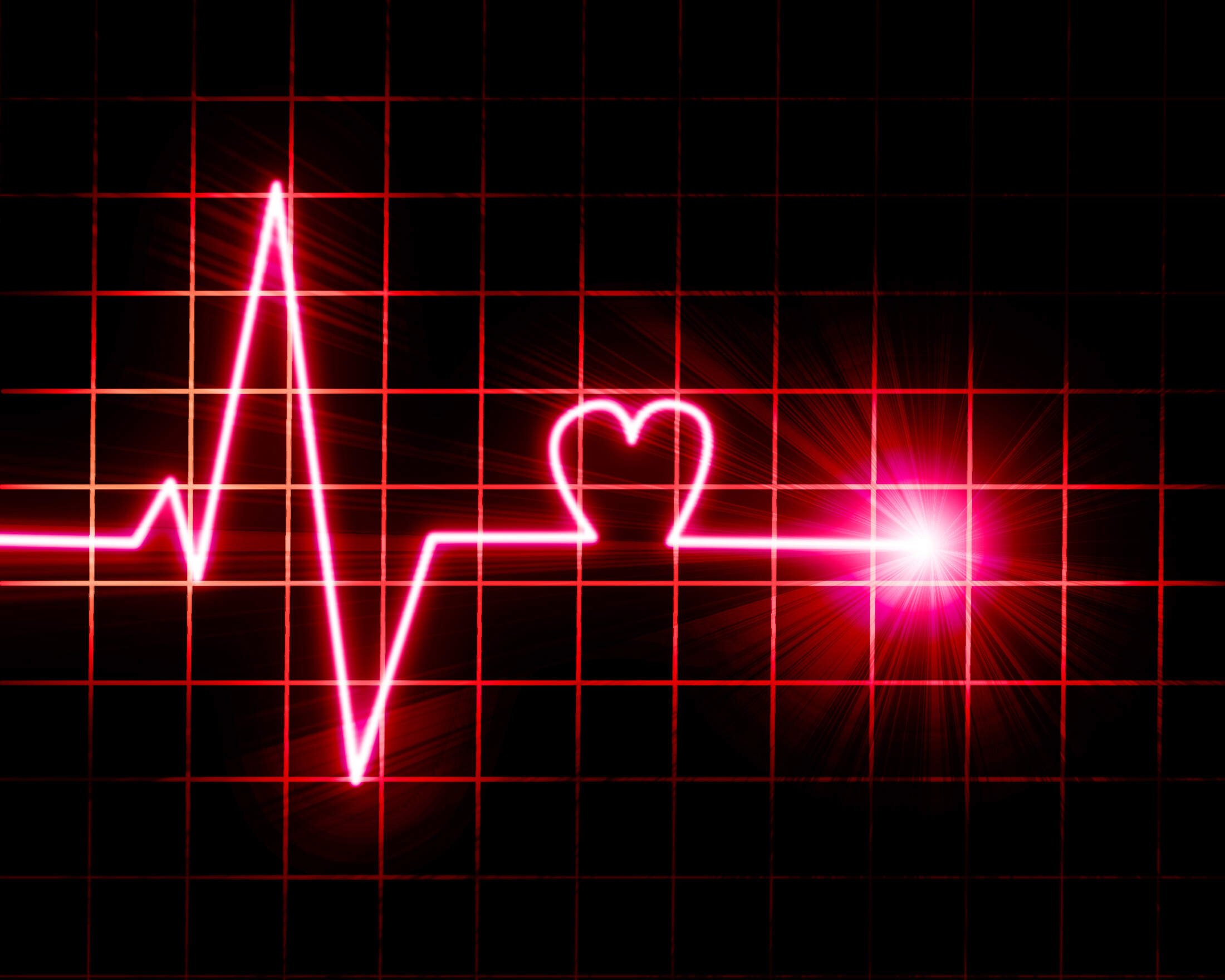 Сердцебиение остановилось. Пульс. Кардиограмма. Пульс сердца. Кардиограмма сердца.